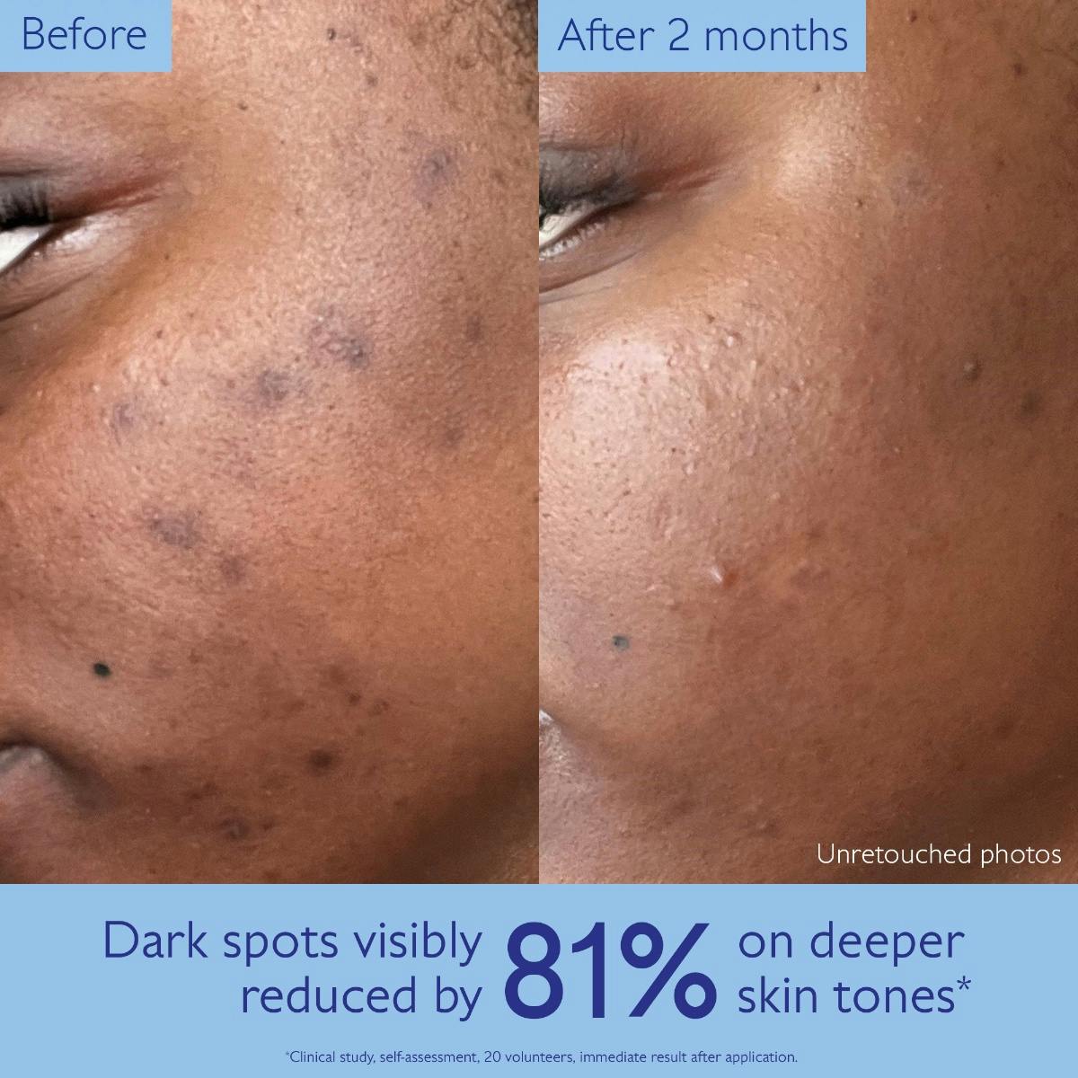 Brightening Dark Spot Serum Vitamin C Alternative