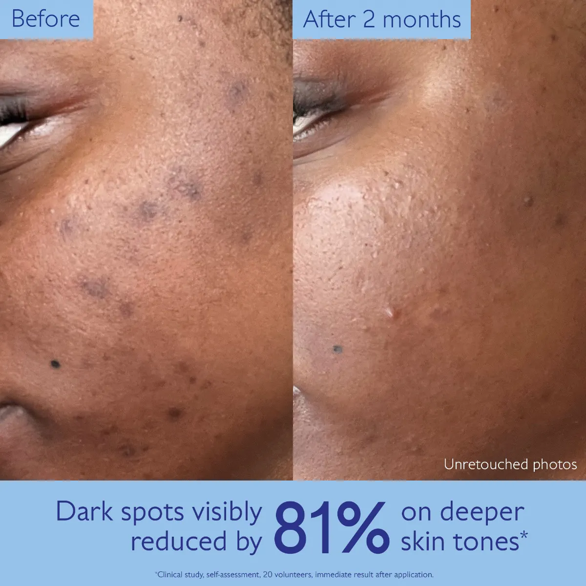 Radiance Serum Complexion Enhancing - Jumbo