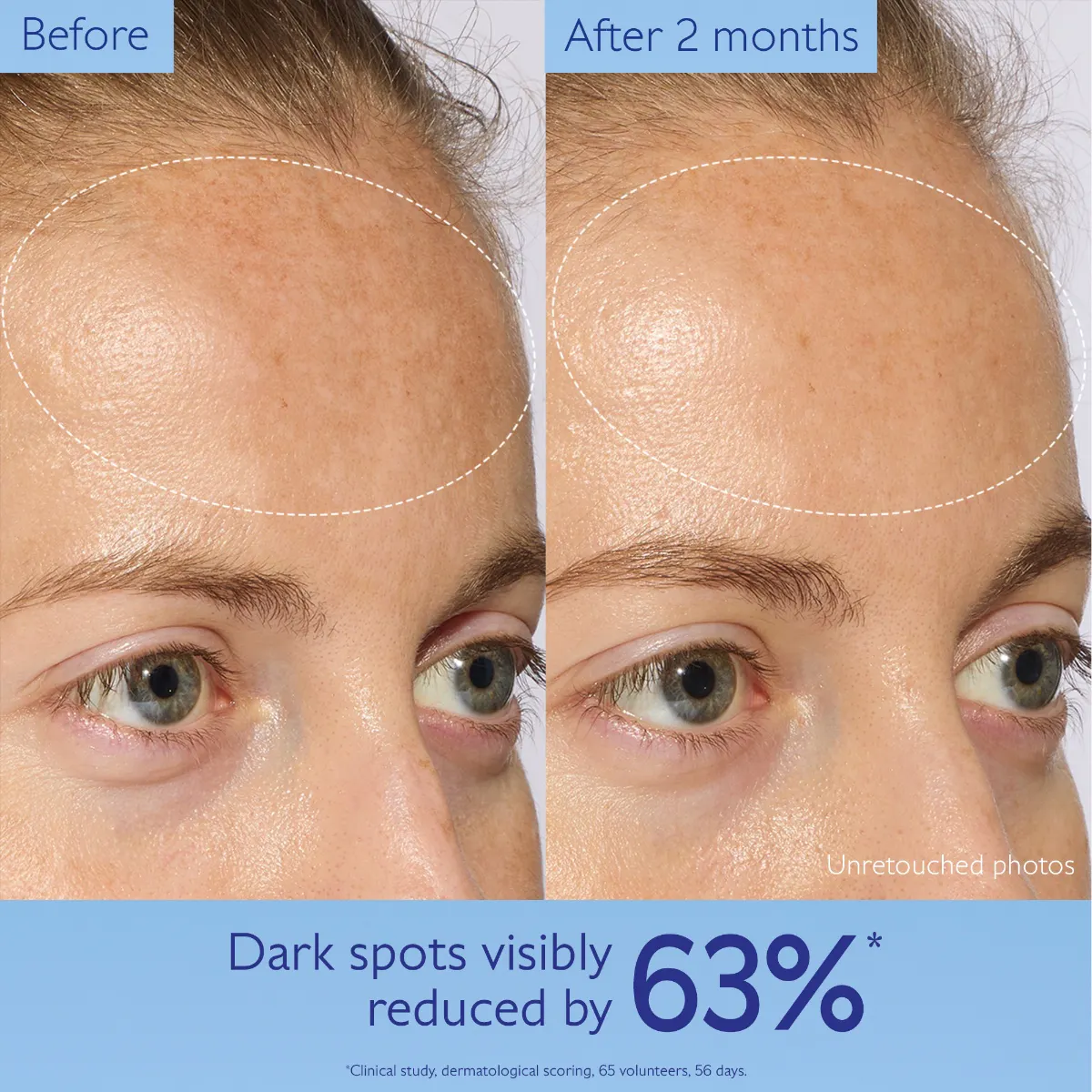 Brightening Dark Spot Serum Vitamin C Alternative